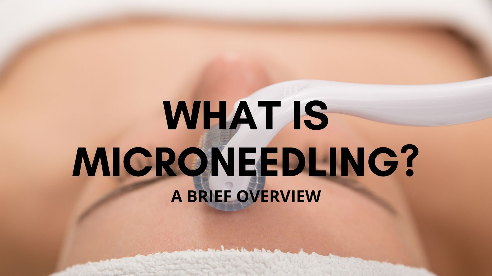 What Is Microneedling?