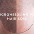 Microneedling for Hair Loss